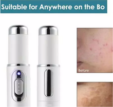 Load image into Gallery viewer, Heath Blue Light Therapy Varicose Veins Treatment Laser Pen Soft Scar Wrinkle Removal Treatment Acne Laser Pen Massage Relax