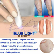 Load image into Gallery viewer, Heath Blue Light Therapy Varicose Veins Treatment Laser Pen Soft Scar Wrinkle Removal Treatment Acne Laser Pen Massage Relax